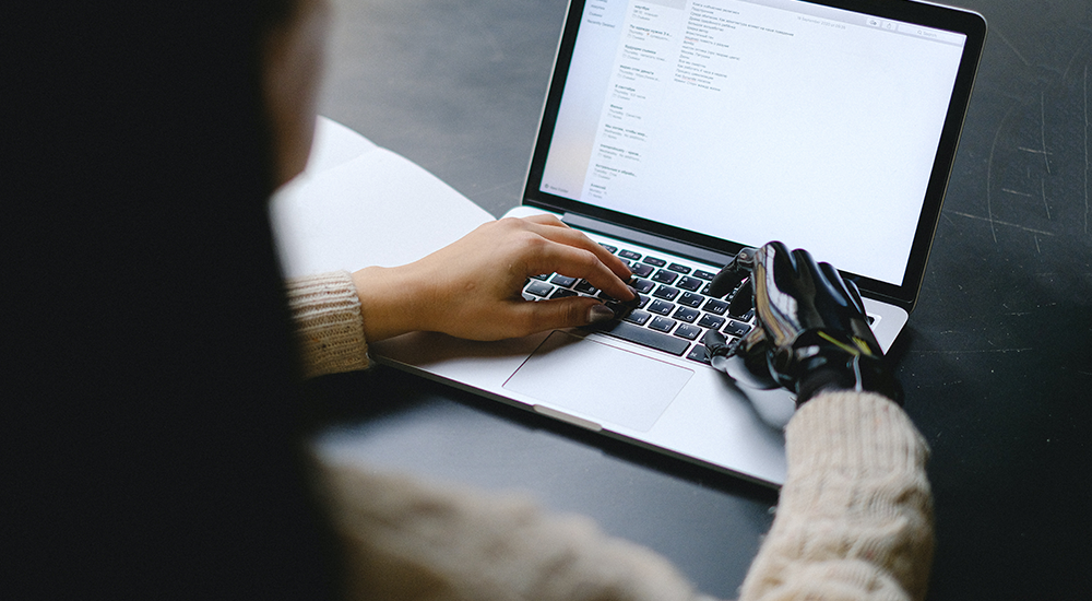 Sie sehen eine junge Frau am Laptop. Durch Ihre Handprothese hat sie motorische Einschränkungen di ihr die Arbeit am Laptop erschweren. Sie ist dankbar über die Möglichkeiten von barrierefreiem Lernen bei E-Learning Kursen von M.I.T